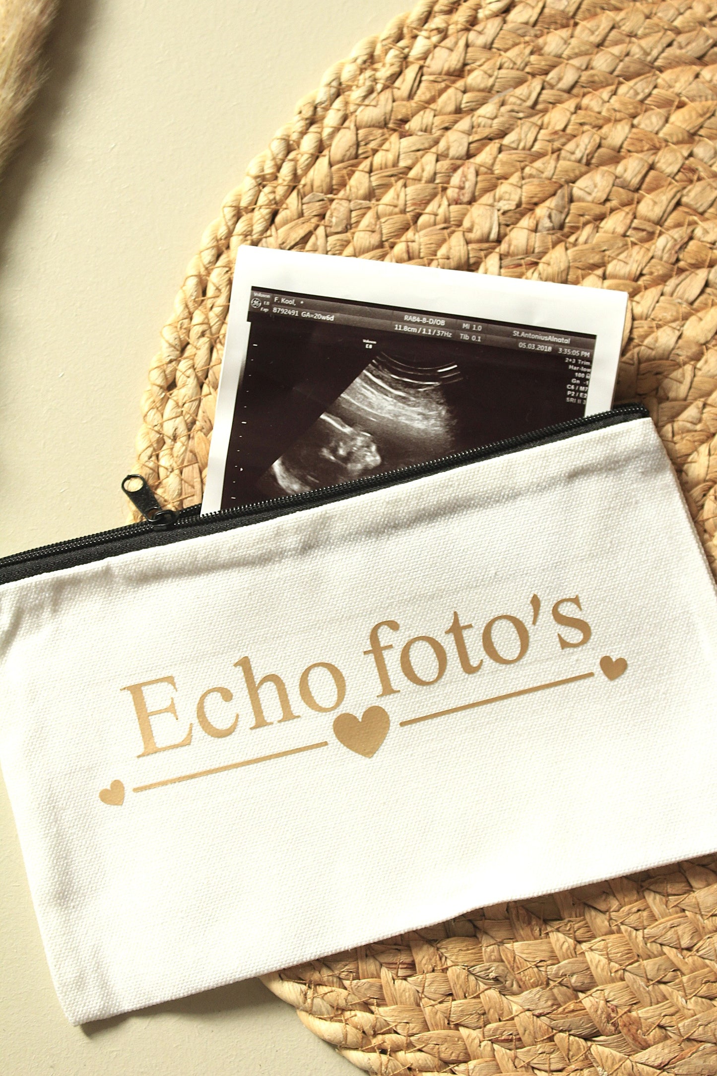 Echofoto's etui voor baby’s – Bewaar je echofoto's veilig | Littlemay.nl